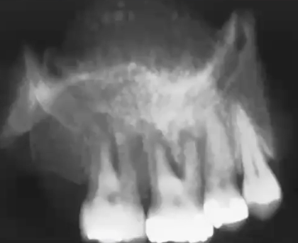<p>What is this PA showing?</p>