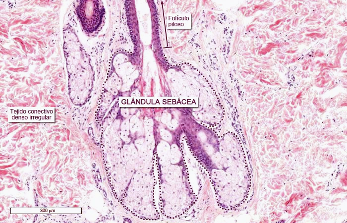 <p>Glándulas Sebáceas</p><ul><li><p>E. Glandular Pluricelular (exocrina).</p></li><li><p>Asociada a lugares donde hay folículos polisos </p></li><li><p>No en manos o pies</p></li></ul><p></p>
