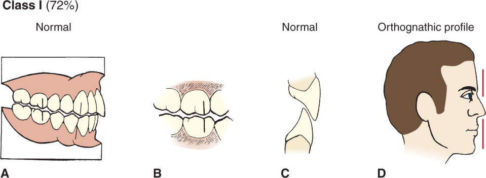 <p>Ideal Class I Occlusion (Normal or Neutroclusion) </p>