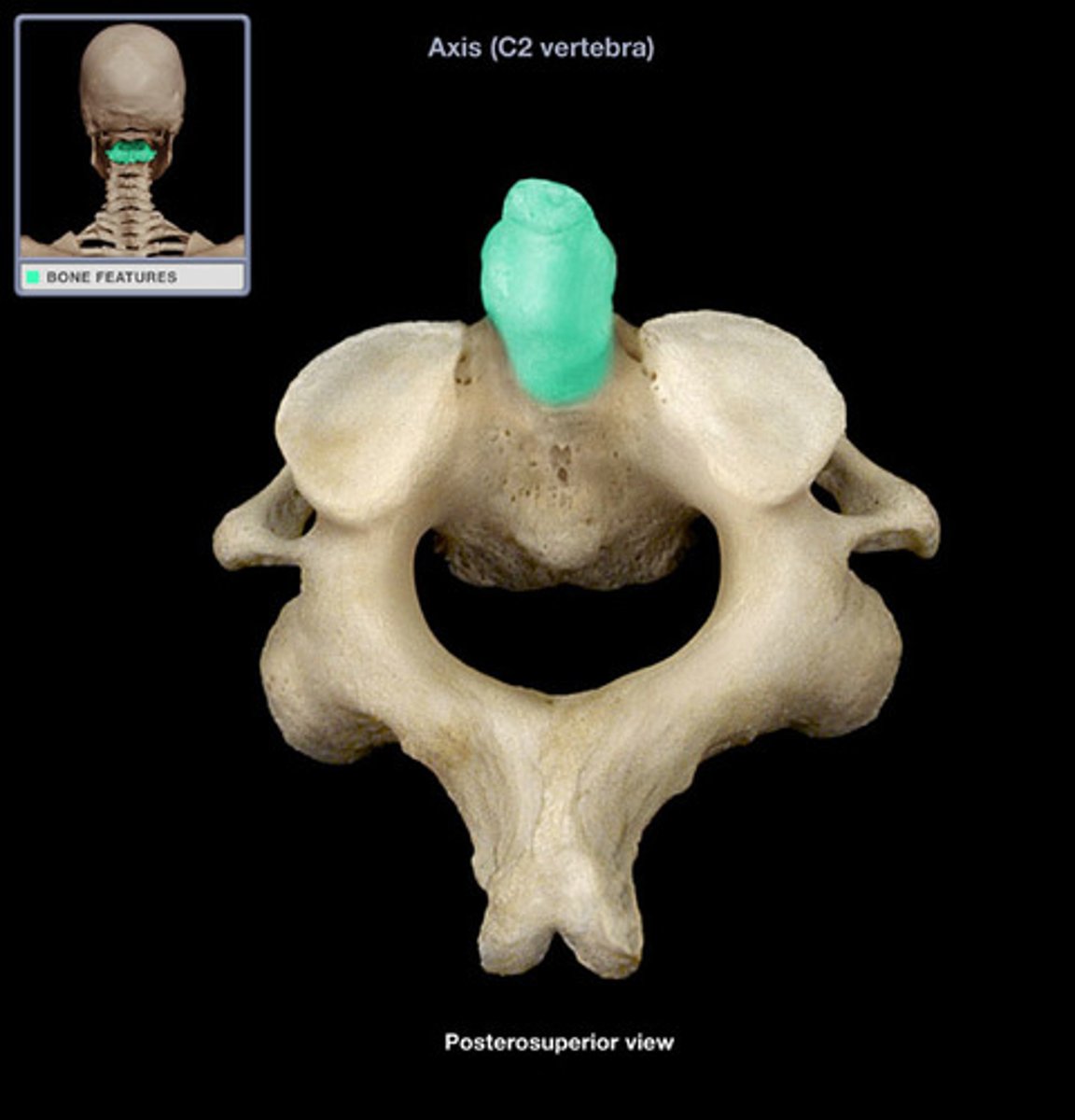 <p>process of the axis which passes through the vertebral foramen of the atlas</p>