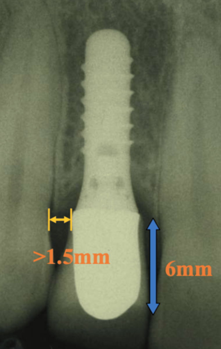 <p>- Bone remodelling cannot extend all way through whole bone</p><p>- Needed for stability of interdental papilla</p>