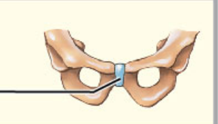 What structural category is this?

What functional category is this?