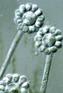 <p><span><strong><em><span>Zygomycota*</span></em></strong></span></p>