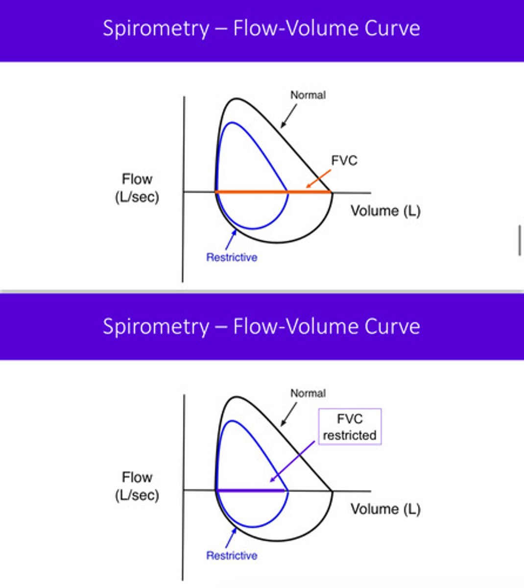 <p>FVC: forced vital capacity which is the total amount of air a person can exhale with maximal effort after taking a deep breath in</p><p>if a patient is restricted, their FVC becomes restricted as they are unable to exhale their full amount —&gt; as a result, the flow volume loop narrows</p>