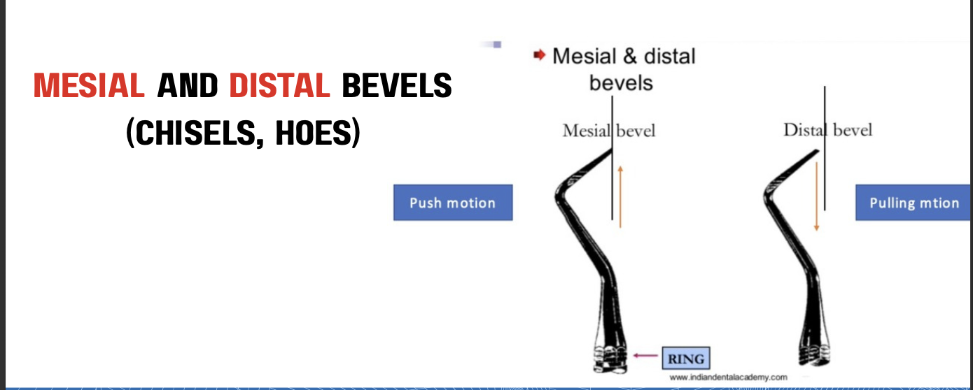 <p>MESIAL or REVERSE BEVEL</p>