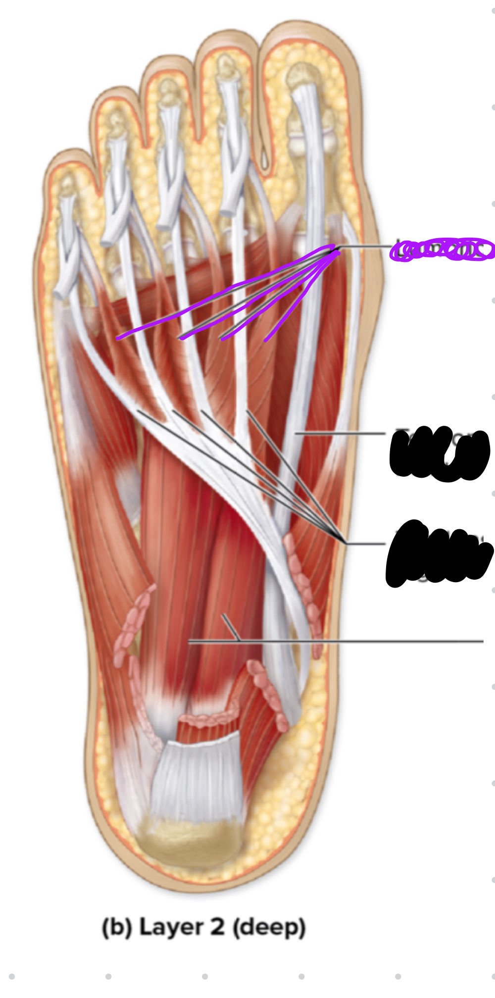 <p>Function?</p>