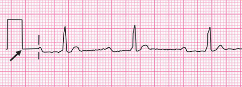 <p>Keeps machine running safe and properly</p><ul><li><p><strong>10mm high</strong></p></li></ul><p></p>