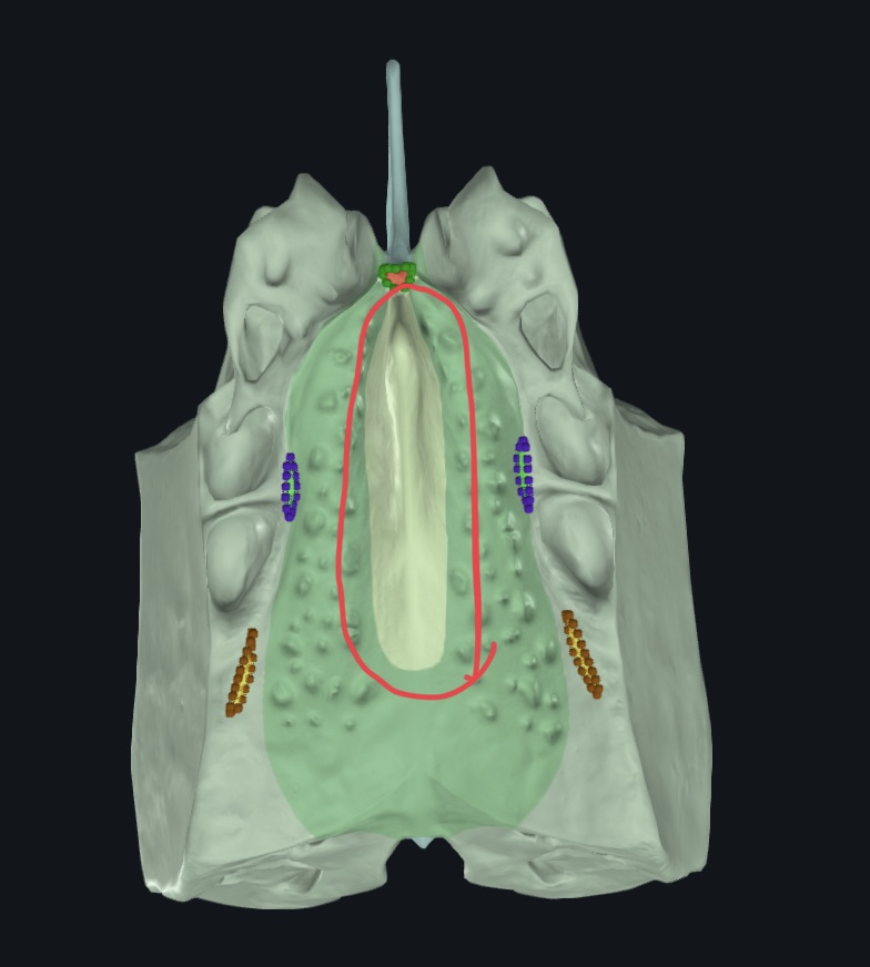 <p>Ethmoid bone</p>