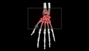 <p>classification of bones?</p>