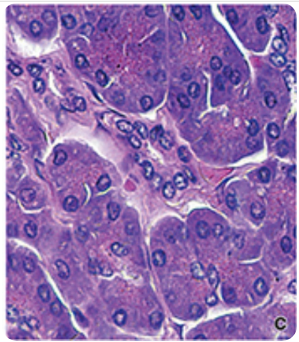 <p>what stain is this?</p>