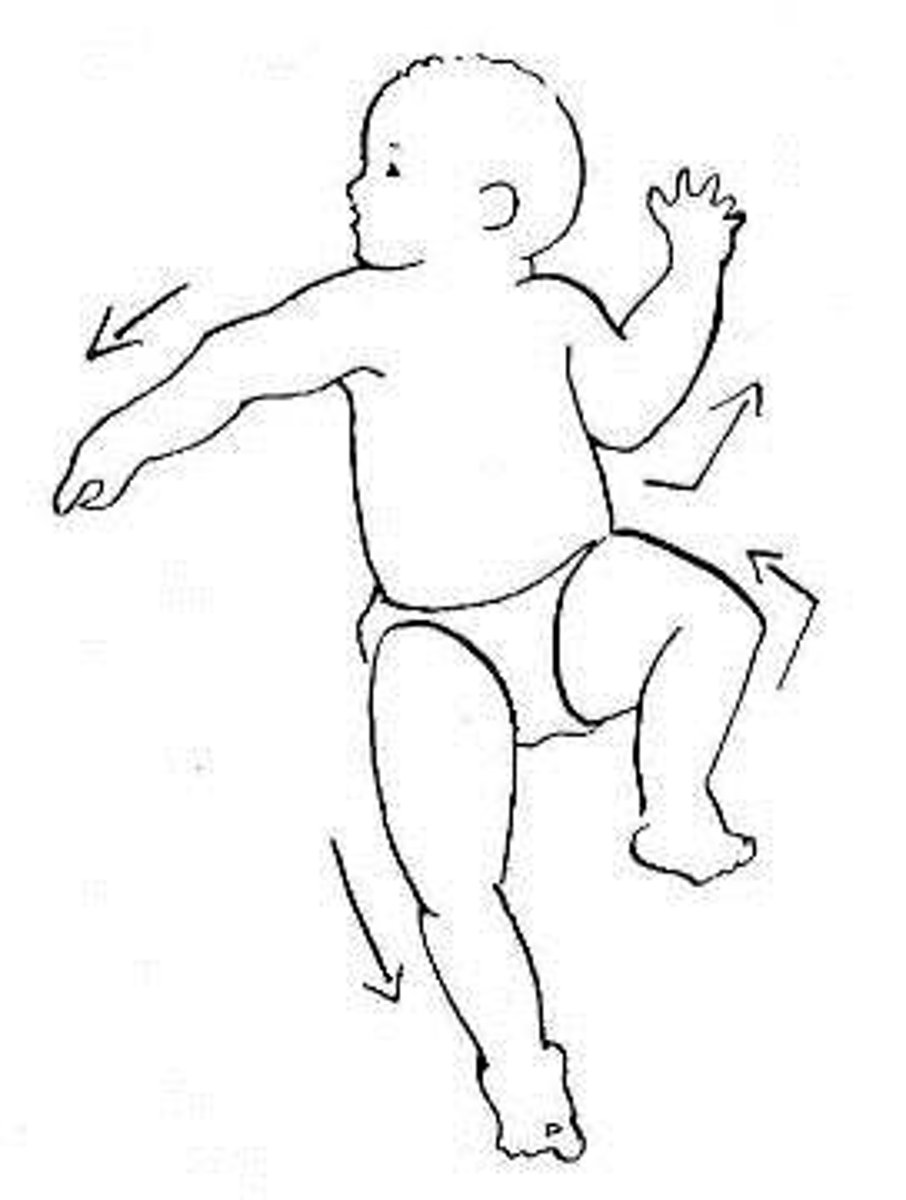 <p>(fencer reflex)</p><p>turn of head result sin face side extends skull side flexes</p><p>ex) head turns to right, right arm and leg extends left arm and leg flexes</p>