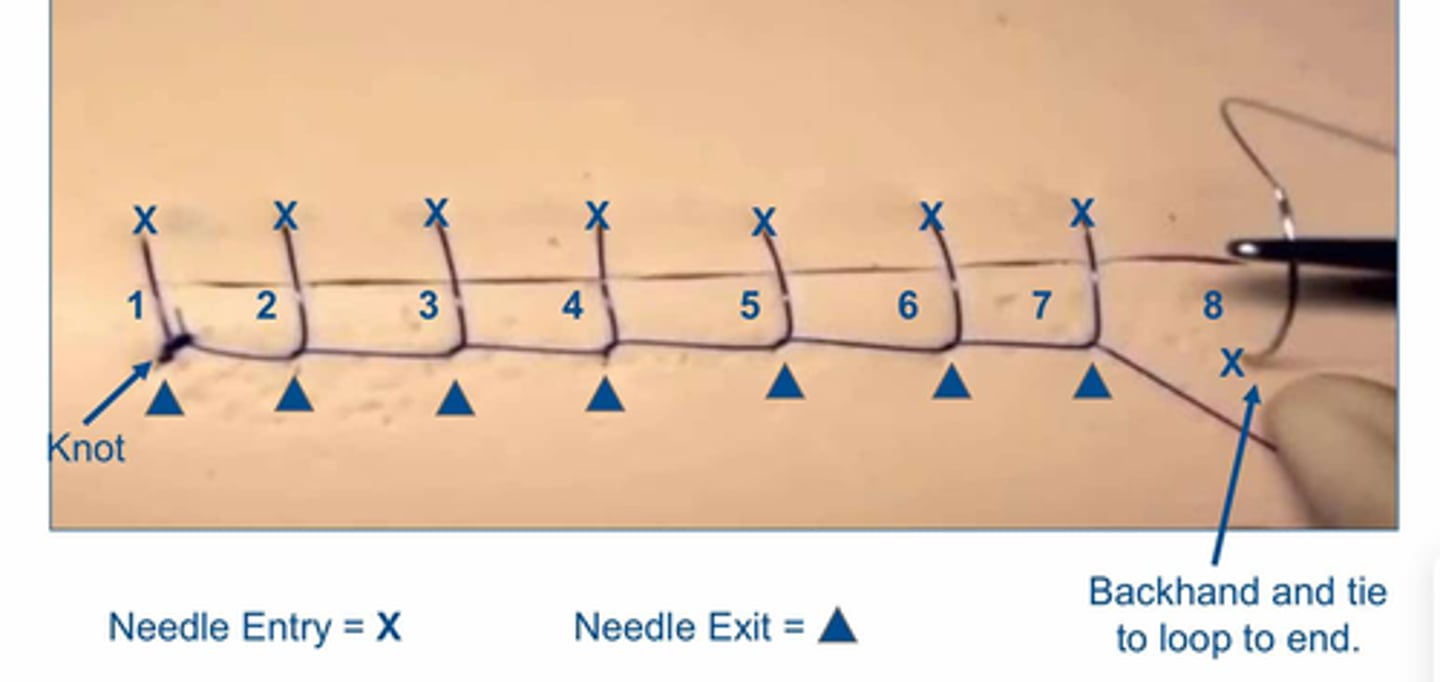 <p>What is this suture pattern?</p>