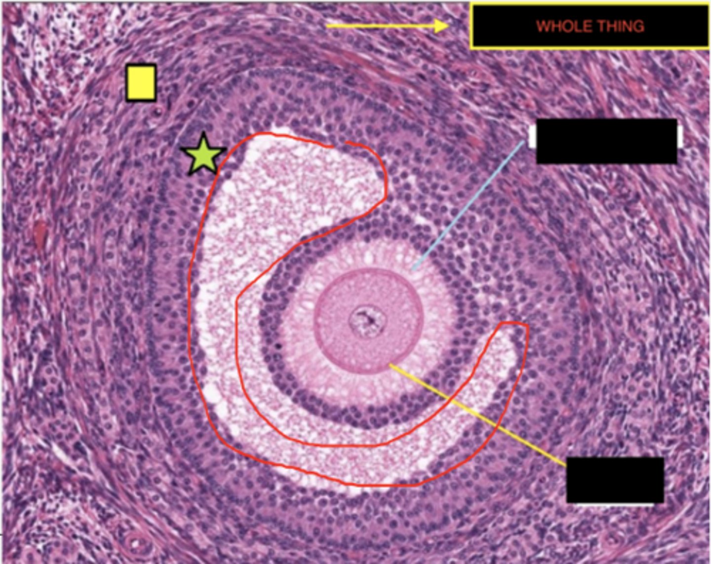 <p>Identify the stage of the follicle</p>