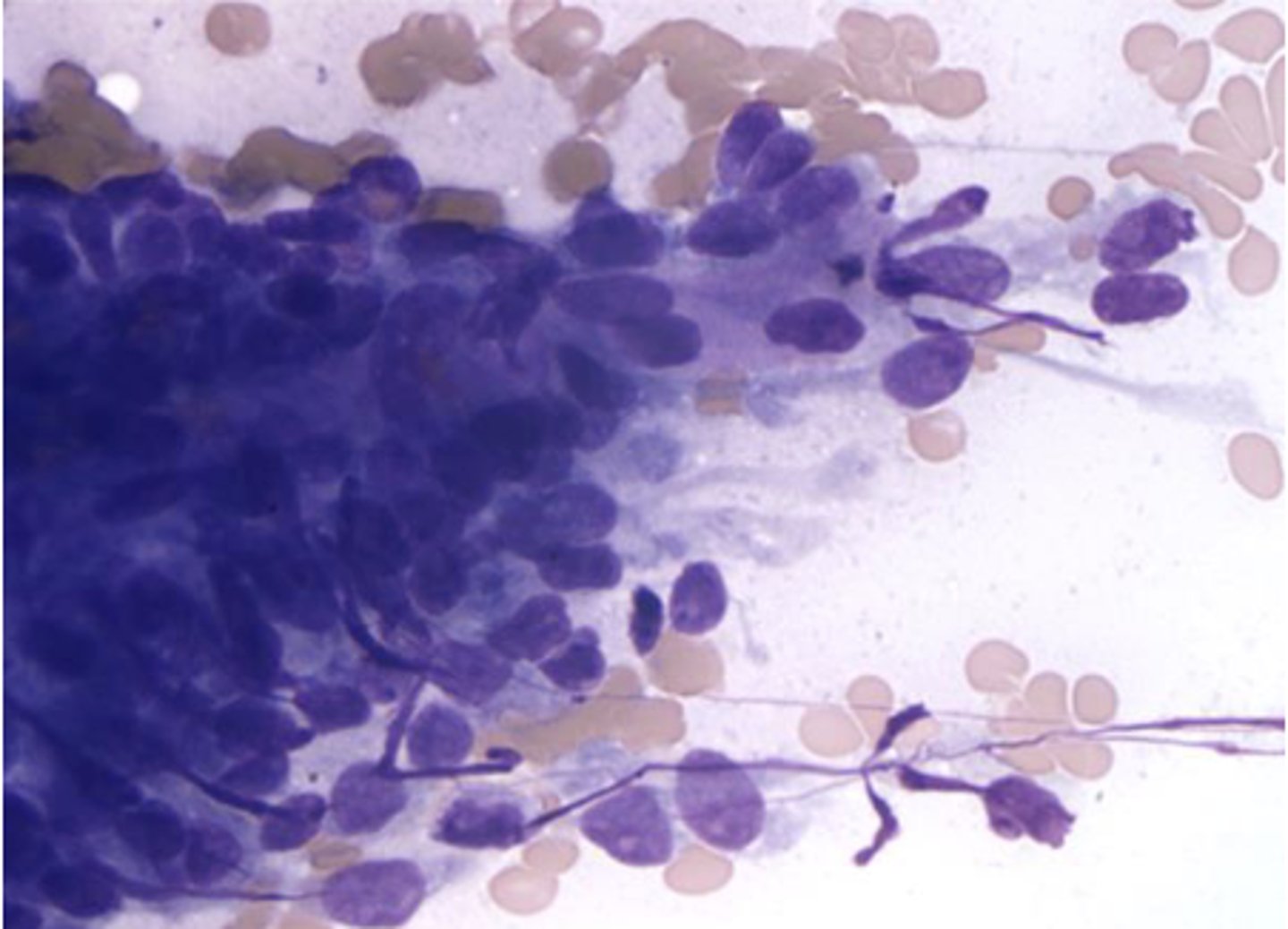 <p>You are examining a cytology slide derived from smooth muscle and note these cigar-shaped nuclei. </p><p>What is your top differential? </p>