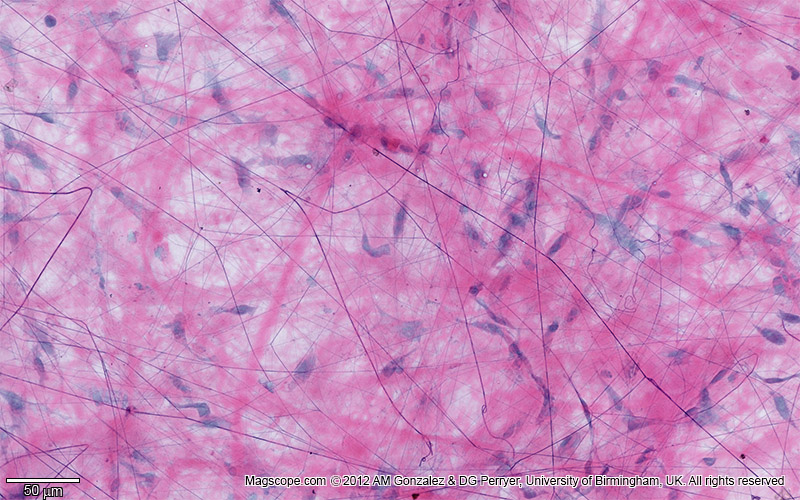 <p>What kind of Loose Connective Tissue is this? Where do you find it?</p>