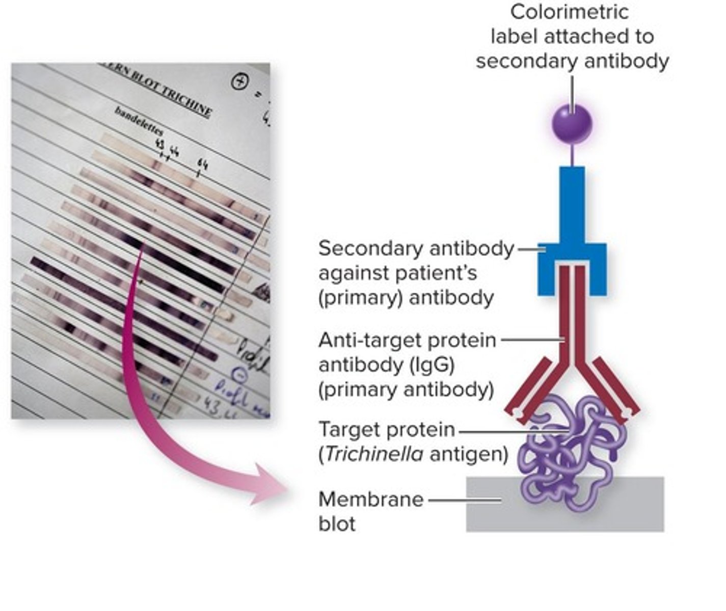 <p>Proteins within cell lysates are separated by electrical charge in a gel.</p>