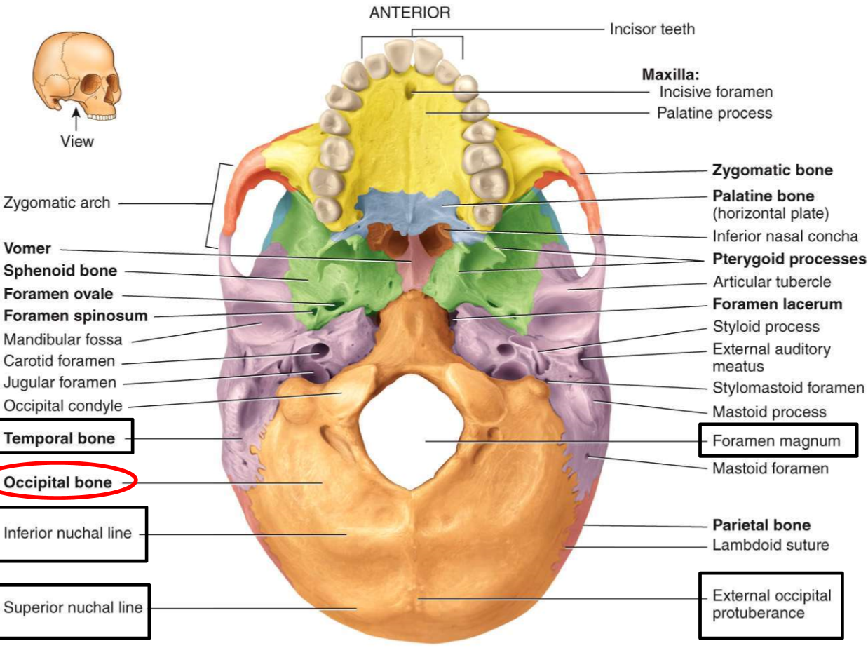 <ul><li><p>foramen magnum</p></li><li><p>occipital condyles</p></li><li><p>external occipital protuberance</p></li><li><p>superior and inferior nuchal lines</p></li></ul>