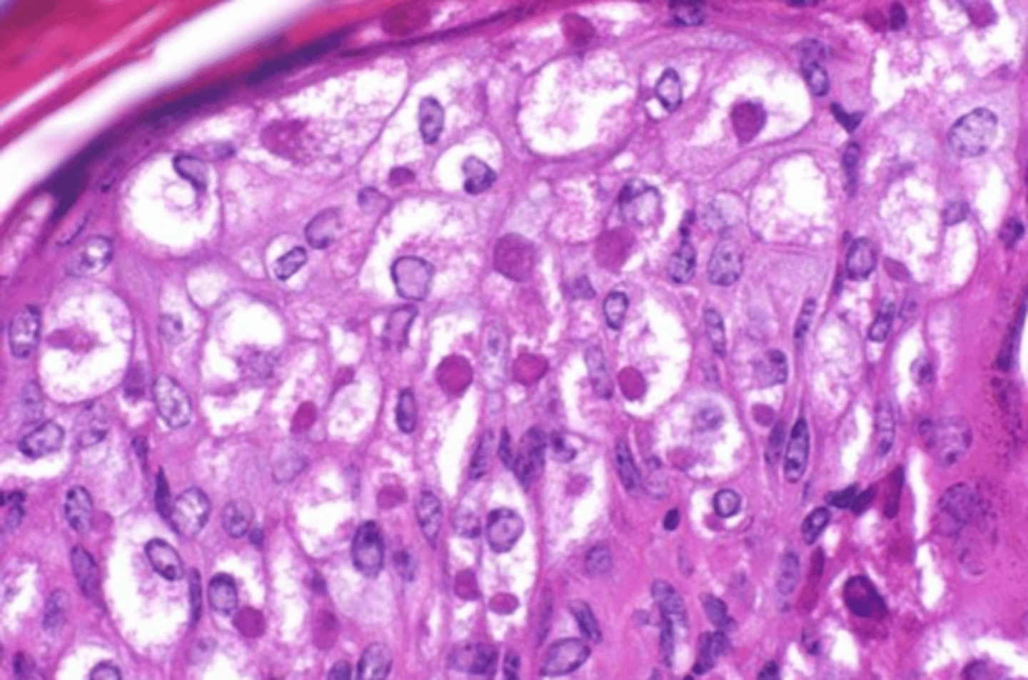 <p>which viral inclusion?</p>