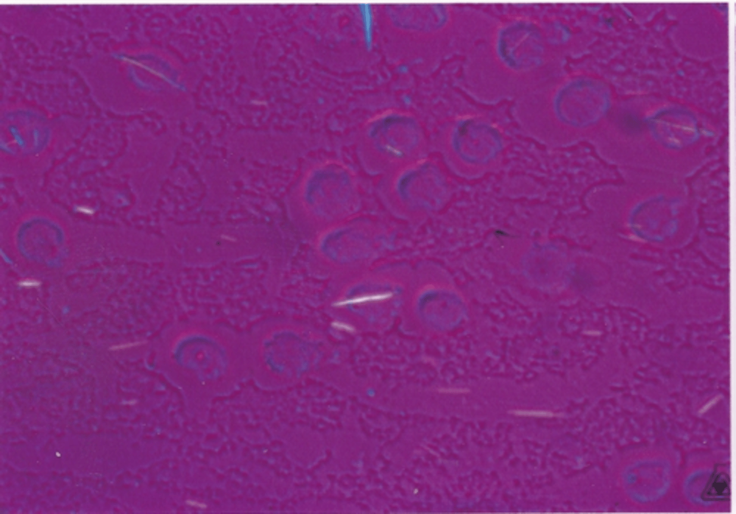 <p>Identify the crystals in this body fluid</p>
