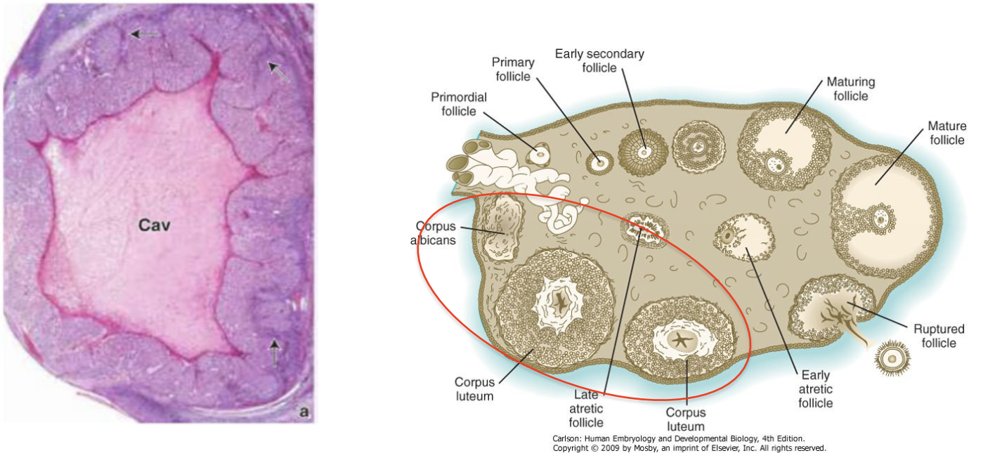 * Ruptured and empty follicle (granulosa cells) left behind after ovulation
* Lutein reaction converts cells to progesterone-producing cells