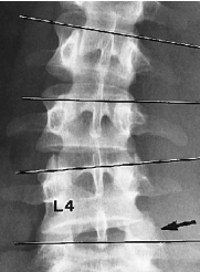 <p>Q what is the name of this measurement? and what is the average + range?</p>