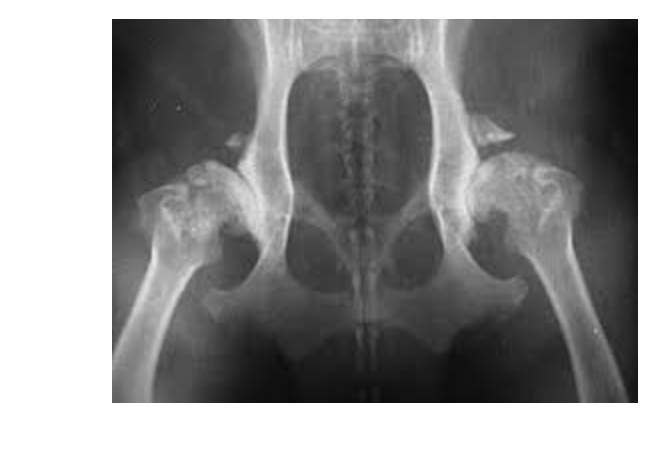 <p>Acetabulum is almost not visible&nbsp;</p><p>Bone spurs above hip joints</p><p>Thickening and remodeling of the femoral head</p>