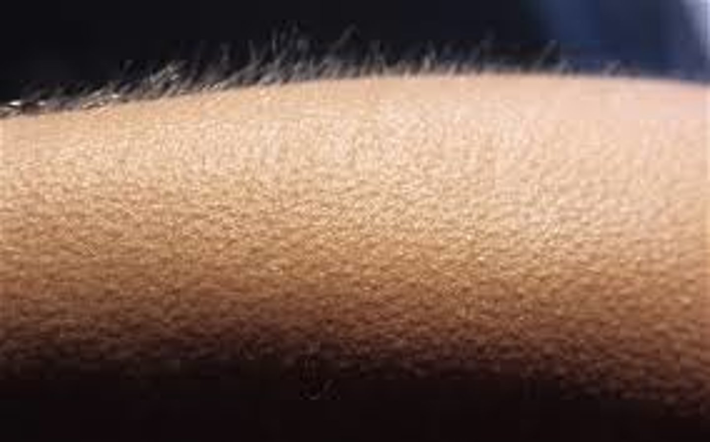 <p>occurs when cold, elevates hairs to trap heat</p>