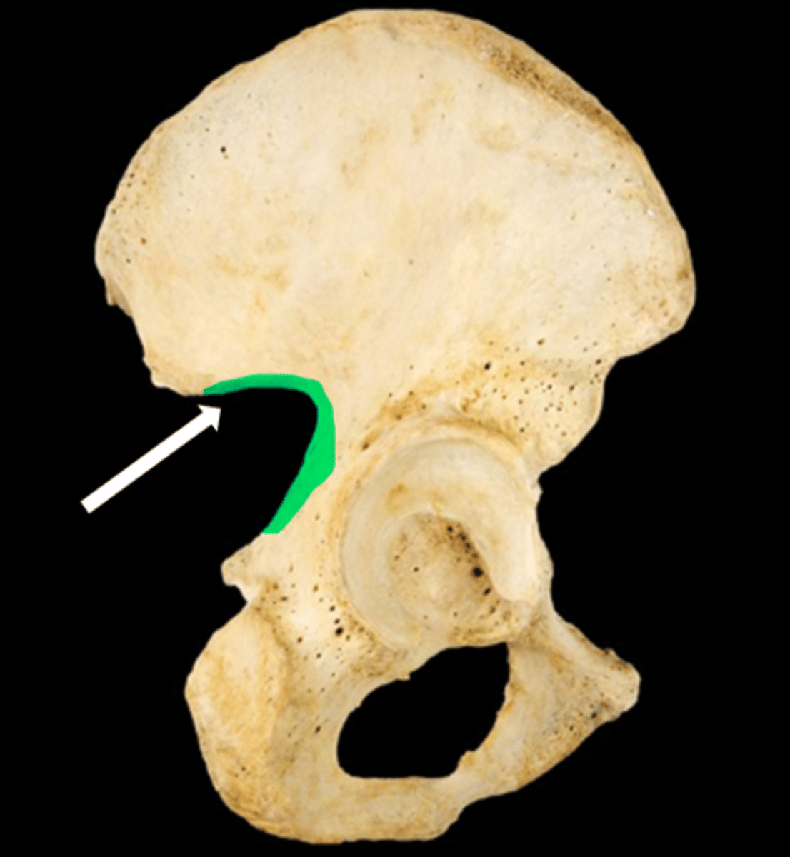 <p>name the part</p>