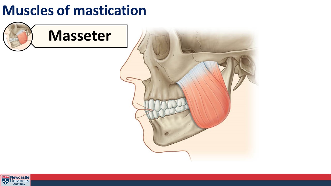 <p>Masseter muscle</p>