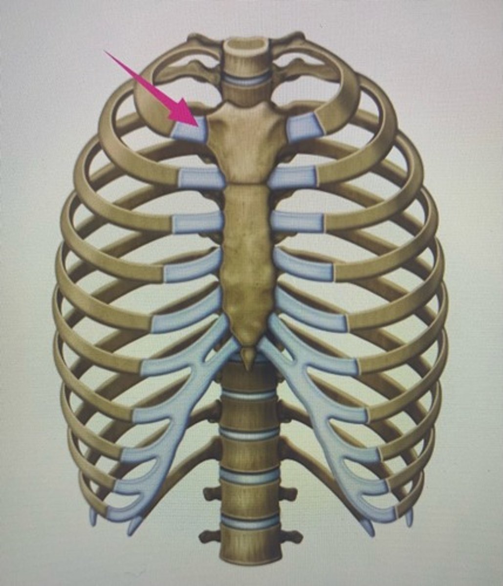 <p>What joint is this?</p>