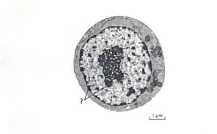 <p>The figure above clearly depicts the nucleolus, a nuclear structure that looks like a large dark region when stained. The other dark-speckled regions in this image, indicated with a question mark, are the locations of compact chromosomal segments called heterochromatin. What is the nucleolus?</p>