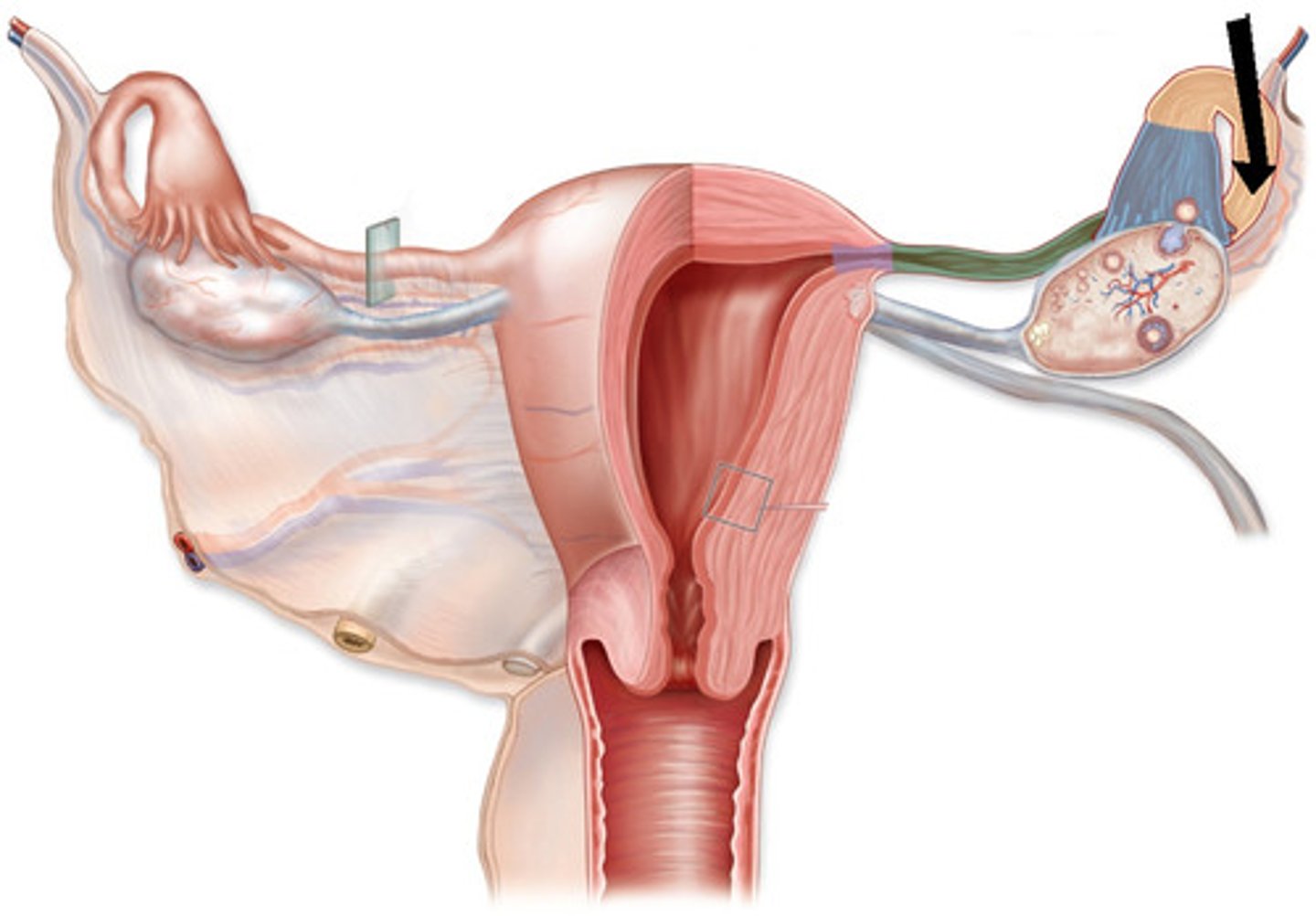 <p>Site of fertilization (1/2 of the duct)</p>