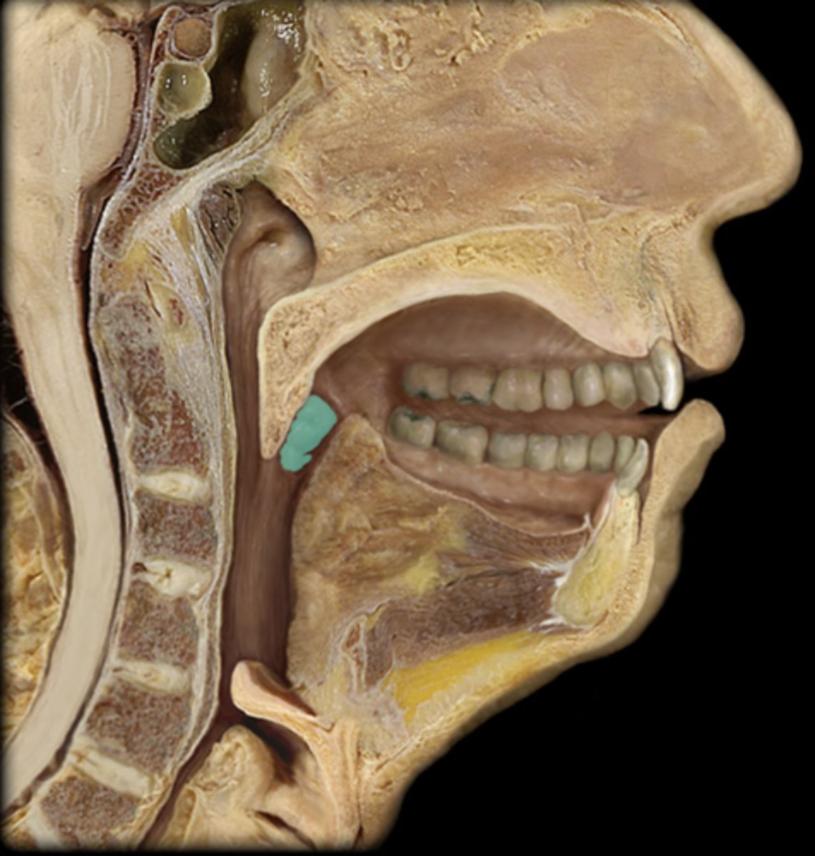 <p>What lymphatic structure is highlighted in this image?</p>