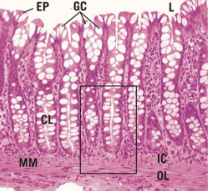 <ul><li><p>small intestine: crypts, lacteals, villi</p><ul><li><p>ONLY one w/ M cells</p></li></ul></li><li><p>large intestine: crypts</p></li></ul><p></p>
