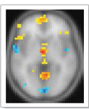 <p><strong>What areas are involved with episodic memories and semantic memories?</strong></p>