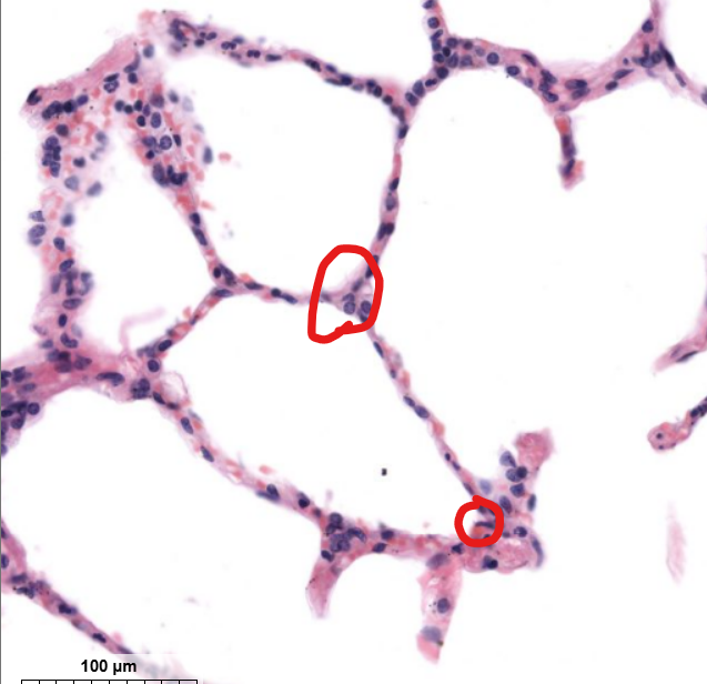 <p>tissue type</p>