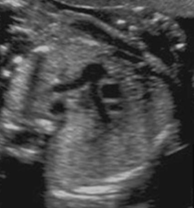 <p>where is superior vena cava</p><ul><li><p>type “next to AO w/o branches”</p></li></ul><p></p>