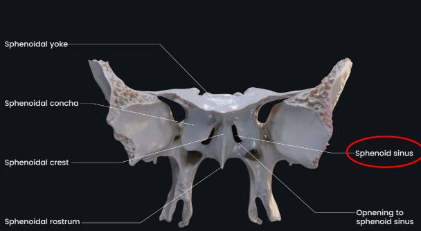 <p>contains two sphenoid sinuses and forms posterior bony wall of nasal cavity</p>
