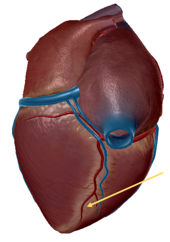 term image