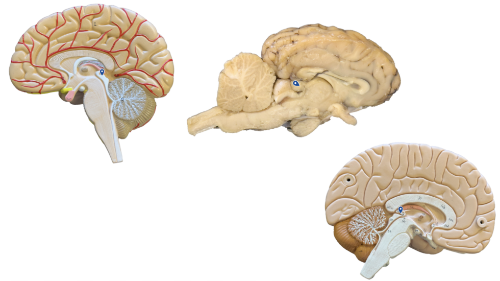 <p>What structure is the arrow pointing to?</p>