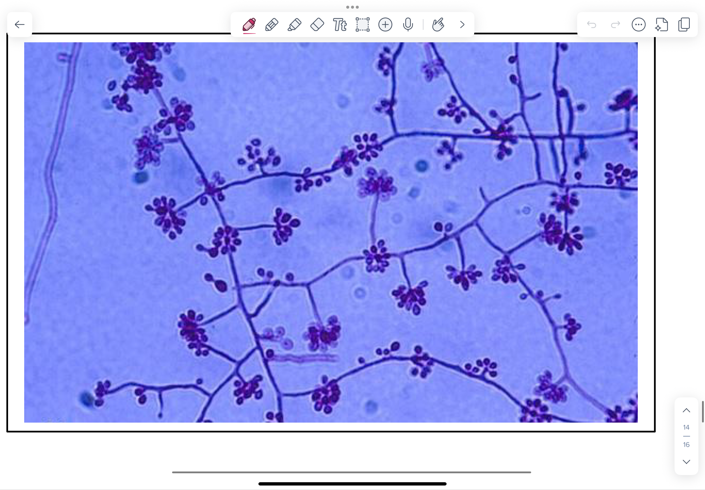 <p>NOTE fine (1.0 -2.0 µm thick) branching, septate hyphae and flowerettes of pyriform conidia on short conidiophores. Typically these flowerettes fragment during preparation and conidia are often scattered.</p>