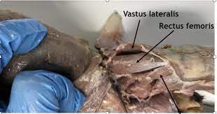 <p>Origin: Anterior Surface of femur</p><p>Insertion: Tibial Crest</p><p>Action: Extends leg</p>