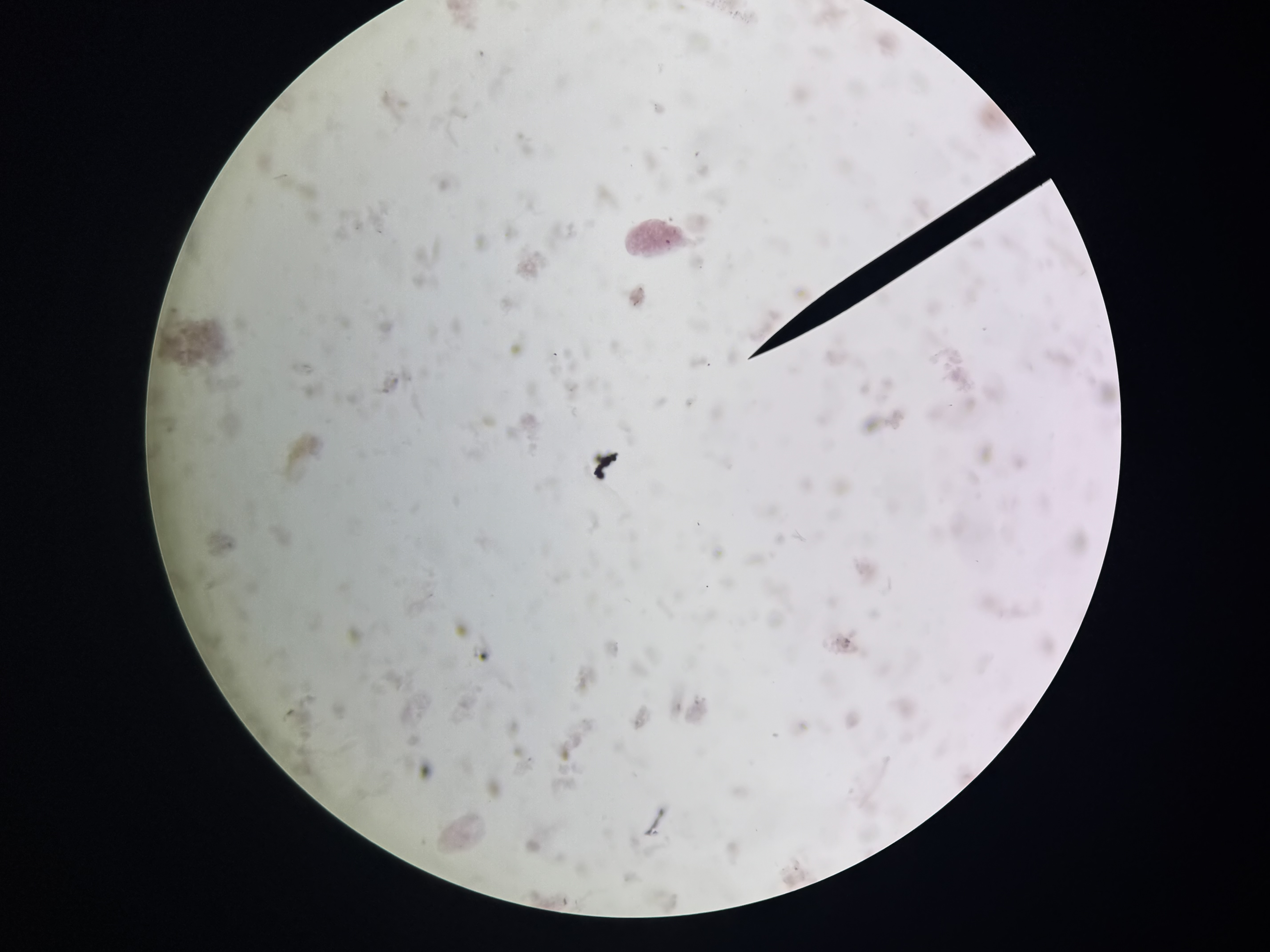 <p>Balantidium coli</p>