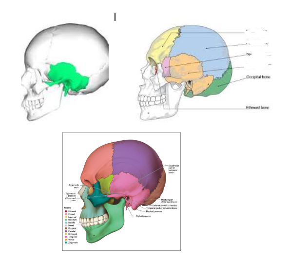 <p>Towards the <strong>SIDES AND BASE (bottom) OF THE SKULL </strong>(kinda near the ear area)</p>