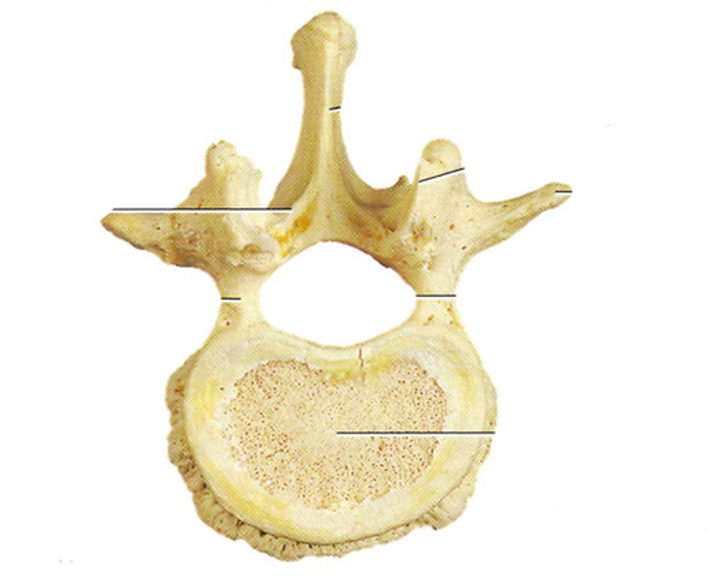 <p>Which vertebrae is this?</p>