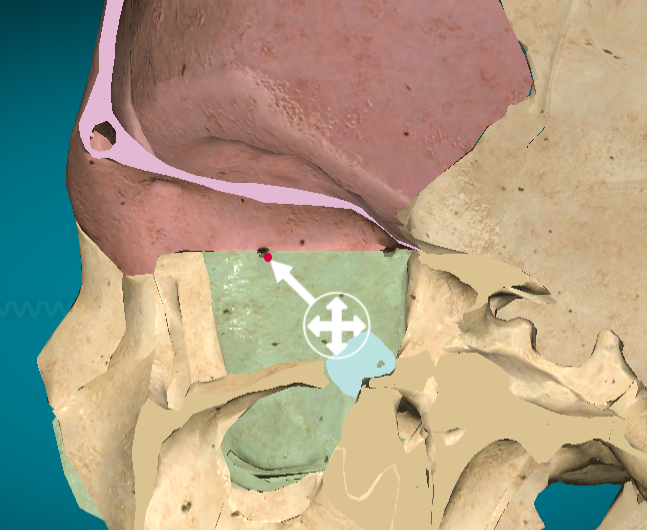<p>Nasolacrimal canal</p>