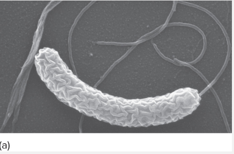 <p>Single flagella at one end</p>