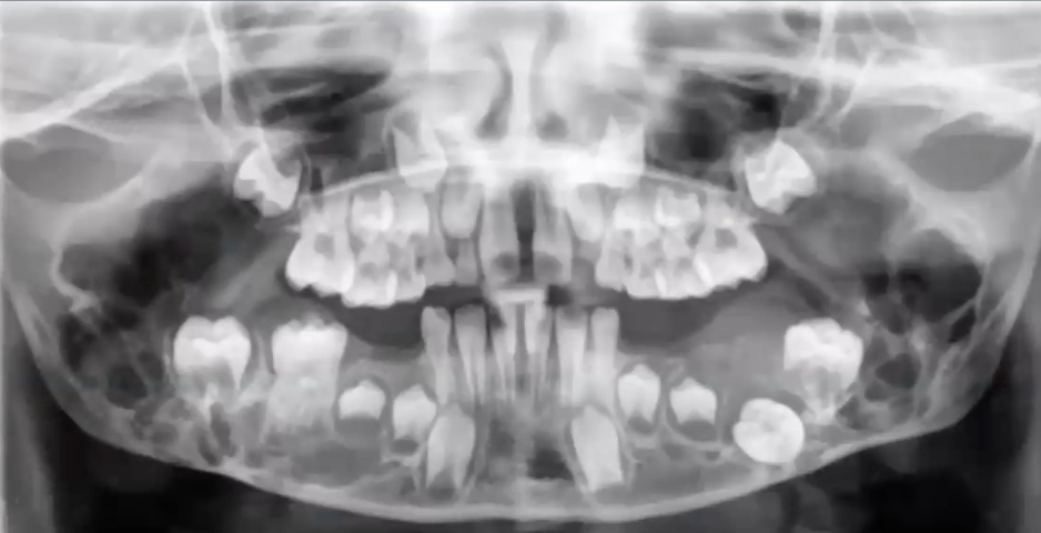 <p>diagnosis?</p>