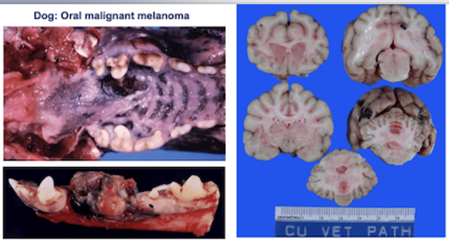 <p>- Usually malignant with frequent metastasis (to brain and lung)</p>