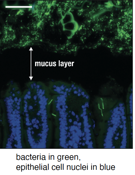 <p>encroaching through the mucus layer </p>